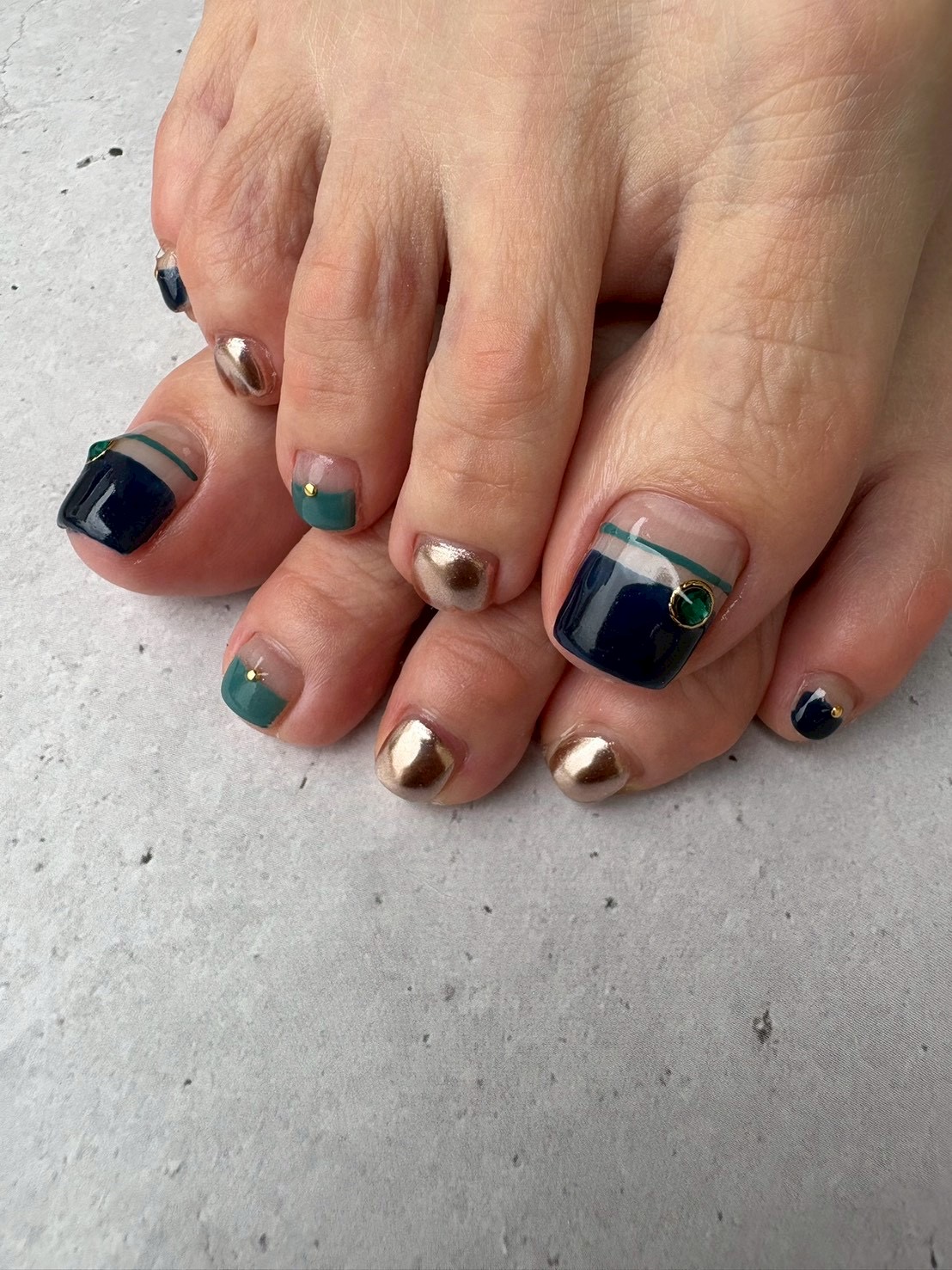 Foot gel nail